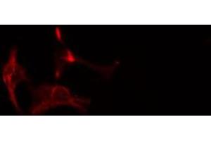 ABIN6275873 staining HepG2 cells by IF/ICC. (HMMR Antikörper  (Internal Region))