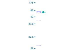 SSB Protein (AA 1-408) (GST tag)