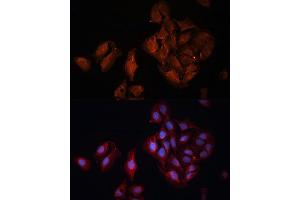Immunofluorescence analysis of U-2 OS cells using B Polyclonal Antibody (ABIN6131247, ABIN6137447, ABIN6137448 and ABIN6222194) at dilution of 1:100 (40x lens). (BAP1 Antikörper  (AA 460-729))