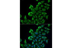 Immunofluorescence analysis of A549 cell using FABP5 antibody.