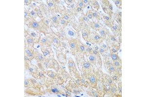 Immunohistochemistry (IHC) image for anti-Prostaglandin-Endoperoxide Synthase 1 (Prostaglandin G/H Synthase and Cyclooxygenase) (PTGS1) (AA 1-180) antibody (ABIN6146413)