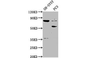 Western Blot Positive WB detected in: SH-SY5Y whole cell lysate, PC-3 whole cell lysate All lanes: ABLIM1 antibody at 1:2000 Secondary Goat polyclonal to rabbit IgG at 1/50000 dilution Predicted band size: 88, 82, 49, 47, 53, 85 kDa Observed band size: 88, 53 kDa (ABLIM1 Antikörper  (AA 174-319))
