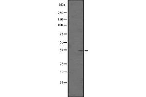 Western blot analysis of OR5AN1 expression in Human placenta tissue lysates ,The lane on the left is treated with the antigen-specific peptide. (OR5AN1 Antikörper  (Internal Region))