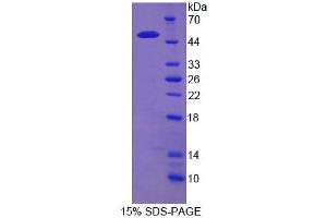 SDS-PAGE (SDS) image for Reticulon 1 (RTN1) (AA 589-776) protein (His tag,GST tag) (ABIN6239379)