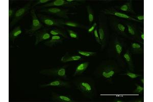Immunofluorescence of purified MaxPab antibody to YY1 on HeLa cell. (YY1 Antikörper  (AA 1-414))