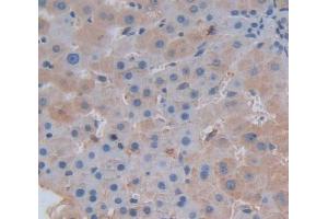 Used in DAB staining on fromalin fixed paraffin- embedded Kidney tissue (SERPINC1 Antikörper  (AA 1-259))