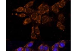 Immunofluorescence analysis of NIH/3T3 cells using CYP11A1 Polyclonal Antibody at dilution of 1:100. (CYP11A1 Antikörper)