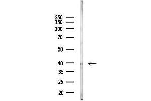 Western blot analysis of lysates from HepG2 cells(starvation,24h treatment), using CDK5R2 Antibody at 1/1000 dilution.