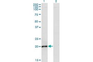 Western Blot analysis of IL6 expression in transfected 293T cell line by IL6 monoclonal antibody (M02), clone 2D12. (IL-6 Antikörper  (AA 29-212))