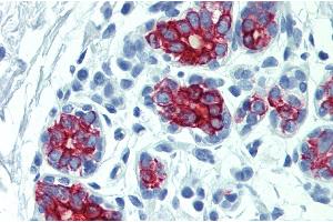 Immunohistochemistry staining of human breast (paraffin-embedded sections) with anti-cytokeratin 7+17. (Keratin 7/17 Antikörper)