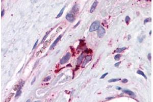 Human Placenta: Formalin-Fixed, Paraffin-Embedded (FFPE) (ADRP Antikörper  (AA 28-281))