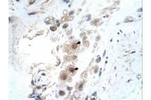 Immunohistochemical staining (Formalin-fixed paraffin-embedded sections) of human placenta with KIAA0494 polyclonal antibody  at 4-8 ug/mL working concentration. (KIAA0494 Antikörper  (N-Term))