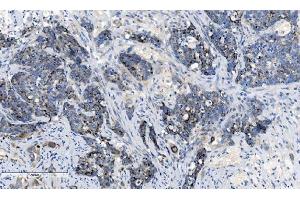 IHC analysis of CHCHD10 using anti-CHCHD10 antibody (ABIN7602507). (CHCHD10 Antikörper  (AA 80-142))
