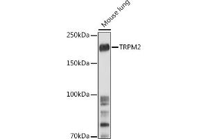 TRPM2 anticorps  (AA 900-1000)