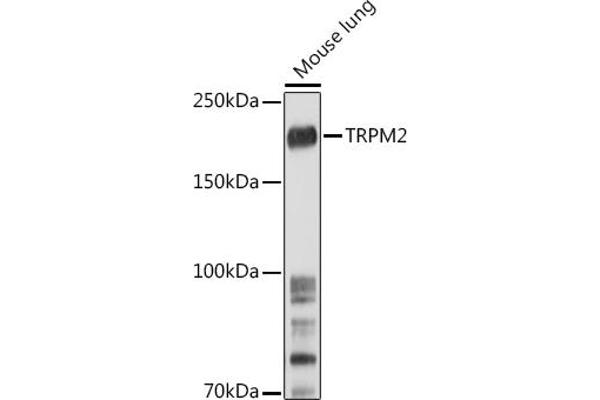 TRPM2 anticorps  (AA 900-1000)