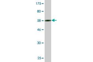 Western Blot detection against Immunogen (61. (RPRD1B Antikörper  (AA 1-326))