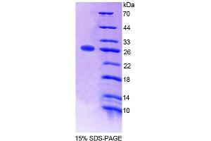 SDS-PAGE analysis of Mouse SNAP23 Protein.