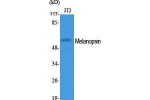 Western Blot (WB) analysis of specific cells using Melanopsin Polyclonal Antibody.
