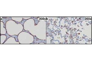 SP-A immunohistochemistry. (Surfactant Protein A1 Antikörper  (Internal Region))