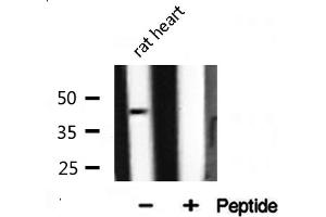 Western blot analysis of extracts from rat liver, using ILKAP antibody. (ILKAP Antikörper  (N-Term))
