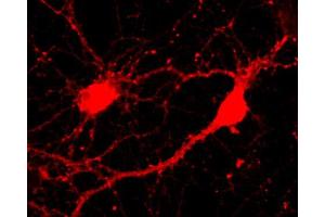 Immunocytochemistry (ICC) image for anti-Protein Kinase C and Casein Kinase Substrate in Neurons 1 (PACSIN1) (AA 293-384) antibody (ABIN1742407)