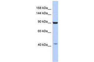 Image no. 1 for anti-Glutamate Receptor Interacting Protein 1 (GRIP1) (AA 950-999) antibody (ABIN6742282) (GRIP1 Antikörper  (AA 950-999))