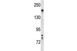 Western Blotting (WB) image for anti-VEGF Receptor 2 (VEGFR2) (AA 920-949) antibody (ABIN3028779)