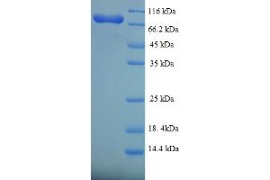 SDS-PAGE (SDS) image for Fanconi Anemia, Complementation Group C (FANCC) (AA 1-558), (full length) protein (His-SUMO Tag) (ABIN5709497)