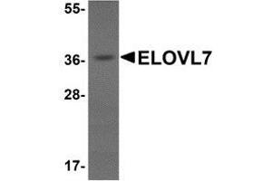 Western blot analysis of ELOVL7 in human liver tissue lysate with AP30312PU-N ELOVL7 antibody at 1 μg/ml. (ELOVL7 Antikörper  (N-Term))