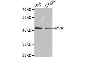 Western blot analysis of extracts of various cell lines, using MVK antibody. (MVK Antikörper)