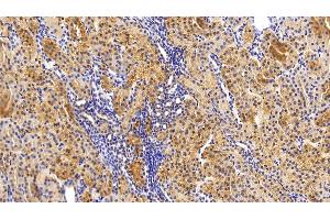 Immunohistochemistry (IHC) image for anti-Thioredoxin Interacting Protein (TXNIP) (AA 32-367) antibody (ABIN7433198)