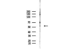 anti-Olfactomedin 1 (OLFM1) antibody