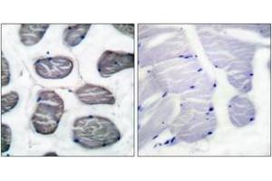Immunohistochemistry analysis of paraffin-embedded human muscle tissue, using Actin-alpha-1 Antibody. (Actin Antikörper  (AA 1-50))