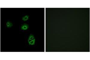 Immunofluorescence analysis of A549 cells, using OR2B2 Antibody. (OR2B2 Antikörper  (AA 241-290))