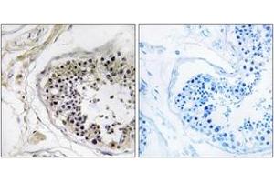 Immunohistochemistry analysis of paraffin-embedded human testis tissue, using CST8 Antibody. (CST8 Antikörper  (AA 31-80))