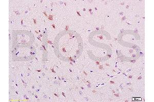 Formalin-fixed and paraffin embedded rat brain labeled with Anti-phospho-NRP1(Thr916) Polyclonal Antibody, Unconjugated (ABIN710756) at 1:200 followed by conjugation to the secondary antibody and DAB staining. (Neuropilin 1 Antikörper  (pThr916))