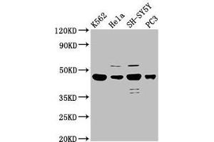 Western Blot Positive WB detected in: K562 whole cell lysate, Hela whole cell lysate, SH-SY5Y whole cell lysate, PC-3 whole cell lysate All lanes: LYAR antibody at 2. (LYAR Antikörper  (AA 1-379))