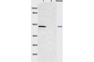 Lane 1: mouse brain lysates Lane 2: mouse kidney lysates probed with Anti Smad3 Polyclonal Antibody, Unconjugated (ABIN747023) at 1:200 in 4 °C.