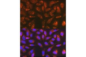 Immunofluorescence analysis of U-2 OS cells using Versican Rabbit mAb (ABIN7271309) at dilution of 1:100 (40x lens). (Versican Antikörper)