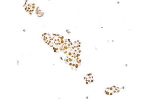 Immunocytochemistry (ICC) image for anti-Paired Box 8 (PAX8) (AA 225-275) antibody (ABIN7795777) (Rekombinanter PAX8 Antikörper  (AA 225-275))