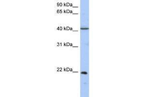 WB Suggested Anti-GUK1 Antibody Titration: 0. (GUK1 Antikörper  (Middle Region))