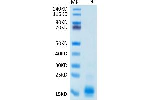 Human MCP-1 on Tris-Bis PAGE under reduced condition. (CCL2 Protein (His-Avi Tag))