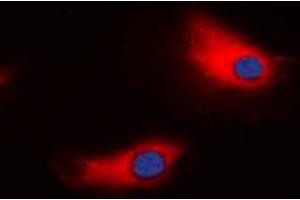 Immunofluorescent analysis of ATP1A1 staining in HeLa cells.