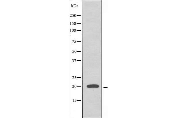 RPL26L1 Antikörper  (C-Term)