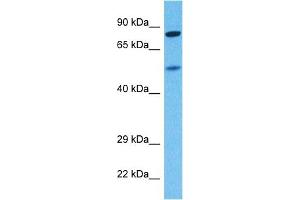 Host:  Rabbit  Target Name:  KCNC4  Sample Tissue:  Human 786-0 Whole Cell  Antibody Dilution:  1ug/ml