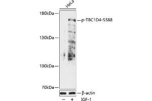 Western blot analysis of extracts of HeLa cells, using Phospho-TBC1D4-S588 antibody (ABIN7270747) at 1:2000 dilution. (TBC1D4 Antikörper  (pSer588))