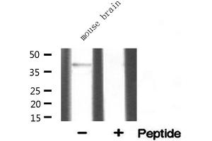 Western blot analysis of extracts from mouse brian, using SGCA antibody. (SGCA Antikörper  (Internal Region))