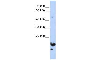 WB Suggested Anti-NUSAP1 Antibody Titration:  0. (NUSAP1 Antikörper  (Middle Region))