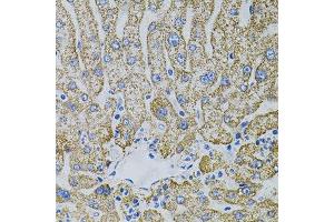 Immunohistochemistry of paraffin-embedded human liver injury using EPO antibody. (EPO Antikörper)