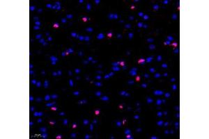 Immunofluorescence of paraffin embedded mouse brain using Adenosine kinase (ABIN7072953) at dilution of 1: 300 (400x lens) (ADK Antikörper)